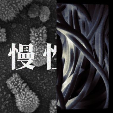 Hush！-异常现象