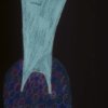 -----