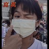 敏感性牙齿真的好痛