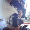 蜂窝性组织炎