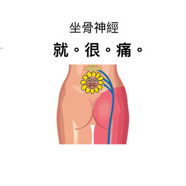 坐骨神经痛